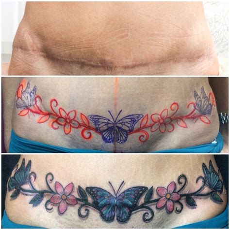 best tummy tuck cover up tattoos|Best Tummy Tuck Cover